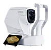 Eidon Widefield Imaging